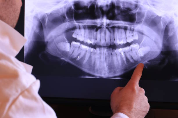 Best Emergency Treatment for Jaw Pain or Injury in Jonesville, LA